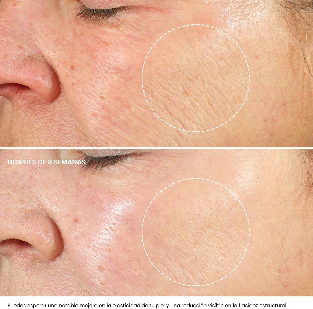 Crema Hidratante Facial Mujer Y Hombres Con Retinol, Ácido Hialurónico Y Vitamina E– Crema Antiarrugas Mujer Para Reducir Arrugas, Líneas Finas Y Manchas Oscuras – Antiedad Facial Crema De Noche -50Ml